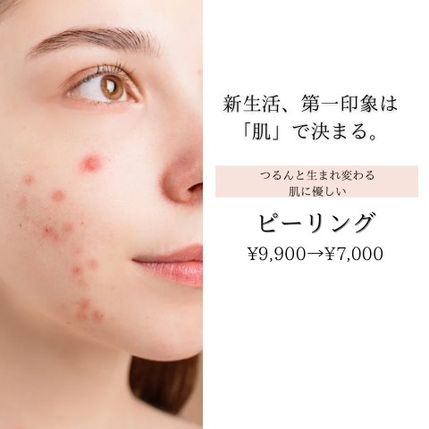 ピーリング